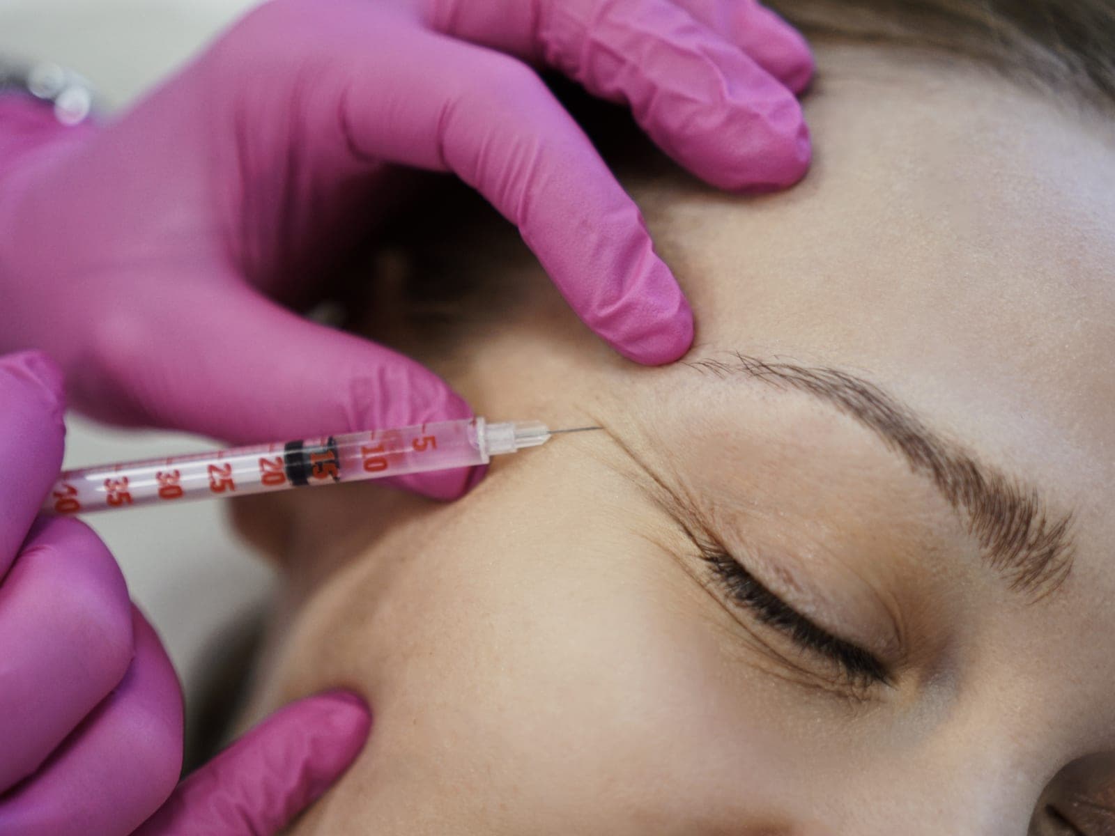 Podanie toksyny botulinowej w okolicę zmarszczki między brwiami — Kliniki Dr Kuschill MEDESTETIS