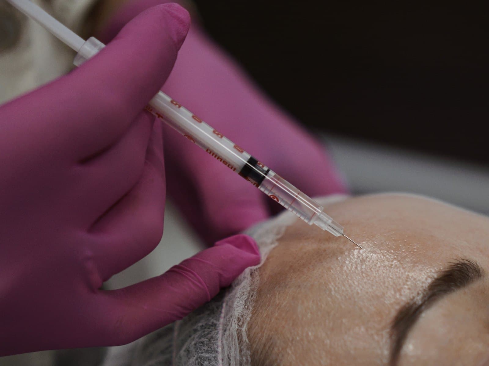 Iniekcja toksyny botulinowej w skórę czoła — Kliniki Dr Kuschill MEDESTETIS