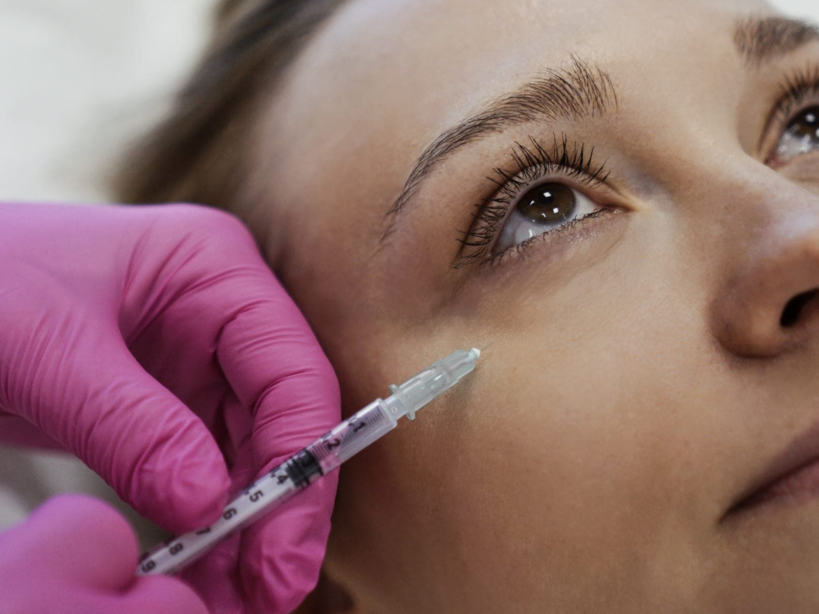 Podanie preparatu w okolicę pod okiem podczas zabiegu likwidacji cieni pod oczami — Kliniki Dr Kuschill MEDESTETIS