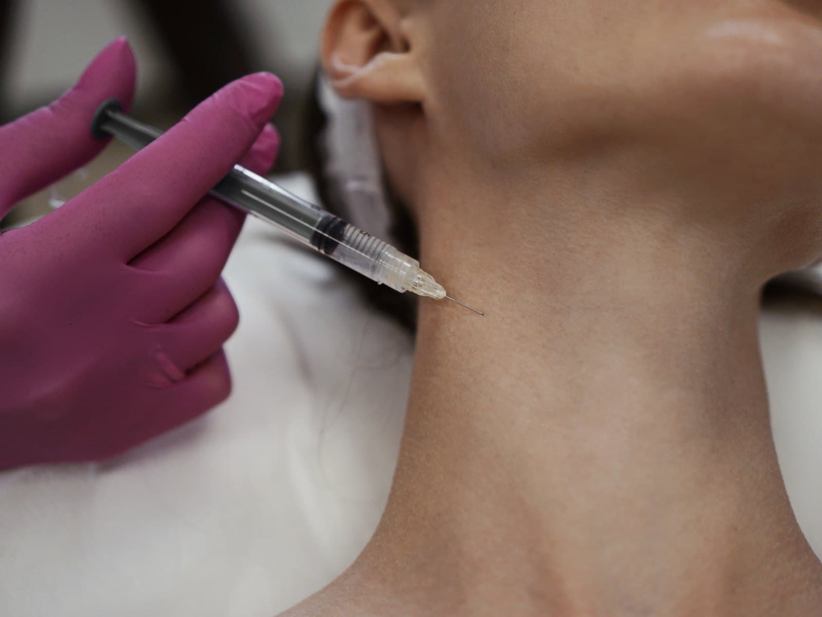 Podanie preparatu igłą w skórę szyi podczas mezoterapii — Kliniki Dr Kuschill MEDESTETIS