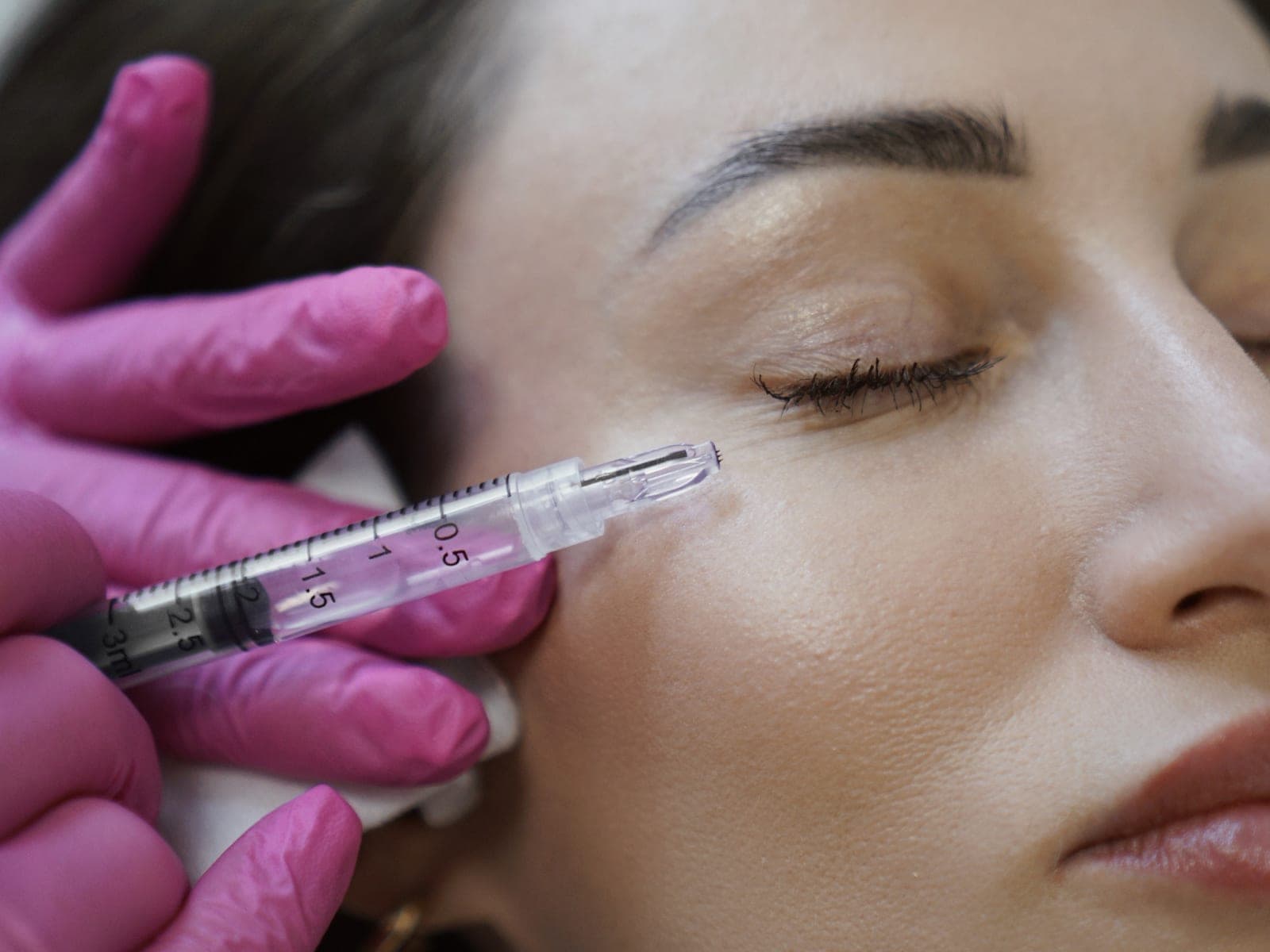 Mezoterapia nanoigłowa okolicy pod okiem — Kliniki Dr Kuschill MEDESTETIS